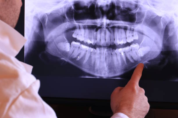 Best Emergency Dentist for Knocked-Out Tooth in Wapakoneta, OH