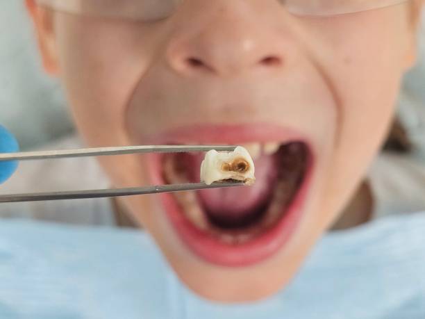 Best Emergency Dental Services for Seniors in Wapakoneta, OH
