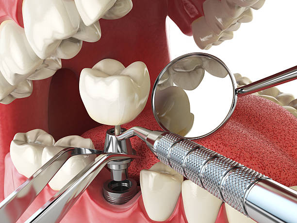 Best Weekend Emergency Dentist in Wapakoneta, OH